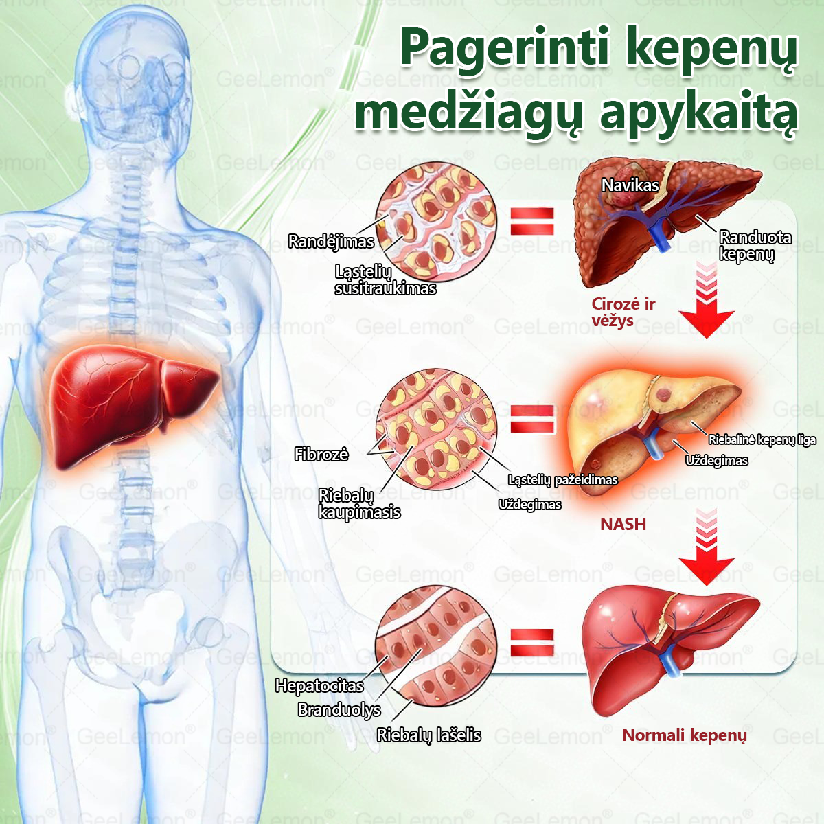 👉 Oficialus sertifikavimas 🔥 Tūkstančiai patenkintų vartotojų Lietuvoje💗👍𝐆𝐞𝑒𝐿𝑒𝐦𝐨𝐧® 𝐆𝐥𝐮𝐦𝐚𝐬𝐞𝐭𝐢𝐝𝐞 8 viename Liekninantis ir sveikatinantis nano pleistras su mikroadatomis 🇱🇹 (Tik kartą per dieną, matomi pokyčiai jau per 7 dienas)  ✅