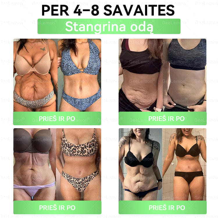 👉 Oficialus sertifikavimas 🔥 Tūkstančiai patenkintų vartotojų Lietuvoje💗👍𝐆𝐞𝑒𝐿𝑒𝐦𝐨𝐧® 𝐆𝐥𝐮𝐦𝐚𝐬𝐞𝐭𝐢𝐝𝐞 8 viename Liekninantis ir sveikatinantis nano pleistras su mikroadatomis 🇱🇹 (Tik kartą per dieną, matomi pokyčiai jau per 7 dienas)  ✅
