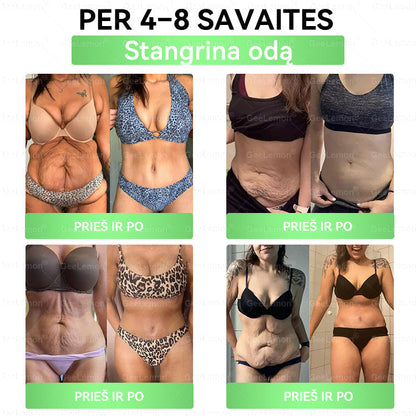 👉 Oficialus sertifikavimas 🔥 Tūkstančiai patenkintų vartotojų Lietuvoje💗👍𝐆𝐞𝑒𝐿𝑒𝐦𝐨𝐧® 𝐆𝐥𝐮𝐦𝐚𝐬𝐞𝐭𝐢𝐝𝐞 8 viename Liekninantis ir sveikatinantis nano pleistras su mikroadatomis 🇱🇹 (Tik kartą per dieną, matomi pokyčiai jau per 7 dienas)  ✅