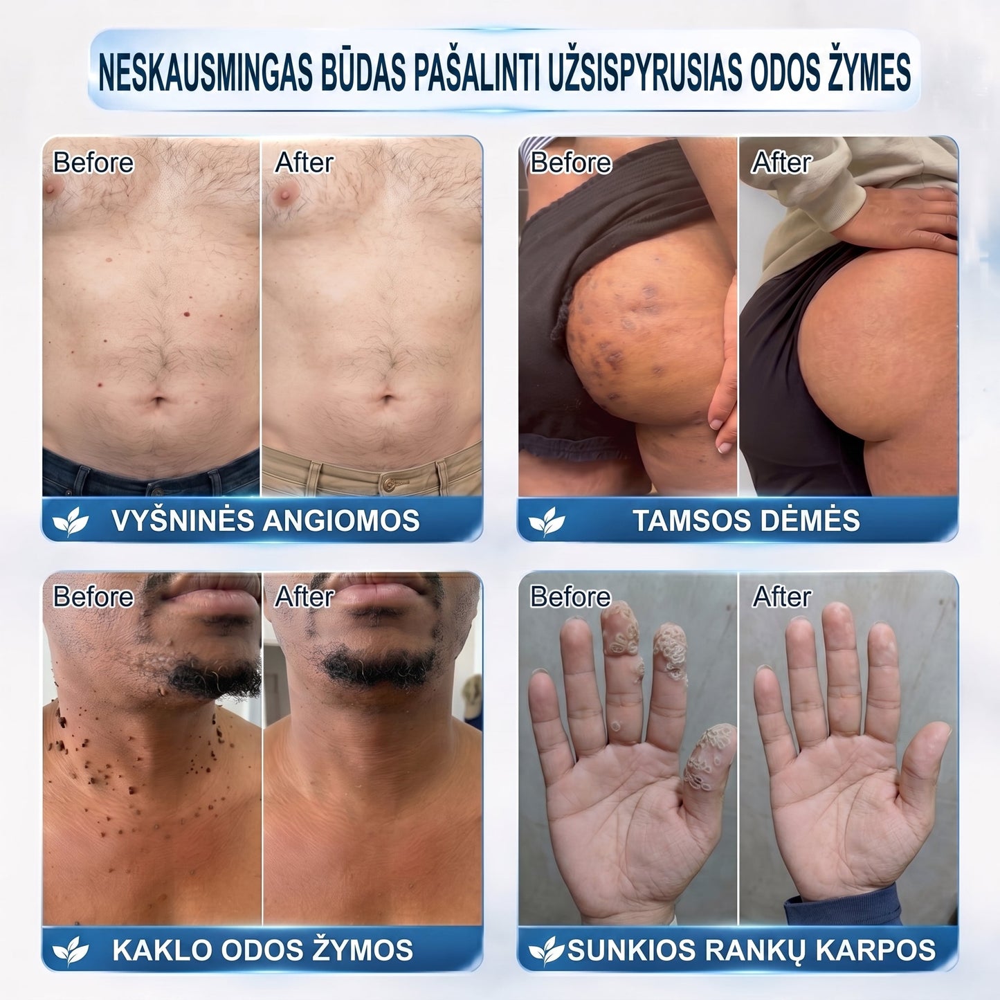 ✅✨𝐎𝐟𝐢𝐜𝐢𝐚𝐥𝐢 𝐩𝐫𝐞𝐤ė𝐬 ž𝐞𝐧𝐤𝐥𝐨 𝐩𝐚𝐫𝐝𝐮𝐨𝐭𝐮𝐯ė 𝐏𝐢𝐜𝐝𝐨® 𝟕 𝐝𝐚𝐲 𝐊𝐚𝐫𝐩𝐮𝐜𝐢𝐮 𝐢𝐫 𝐝𝐞𝐦𝐢𝐲 𝐯𝐚𝐥𝐢𝐤𝐥𝐢𝐬(Neskausmingas, be pėdsakų rutulinis rutulinis) 🚀
