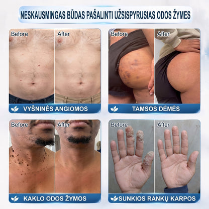 ✅✨𝐎𝐟𝐢𝐜𝐢𝐚𝐥𝐢 𝐩𝐫𝐞𝐤ė𝐬 ž𝐞𝐧𝐤𝐥𝐨 𝐩𝐚𝐫𝐝𝐮𝐨𝐭𝐮𝐯ė 𝐏𝐢𝐜𝐝𝐨® 𝟕 𝐝𝐚𝐲 𝐊𝐚𝐫𝐩𝐮𝐜𝐢𝐮 𝐢𝐫 𝐝𝐞𝐦𝐢𝐲 𝐯𝐚𝐥𝐢𝐤𝐥𝐢𝐬(Neskausmingas, be pėdsakų rutulinis rutulinis) 🚀