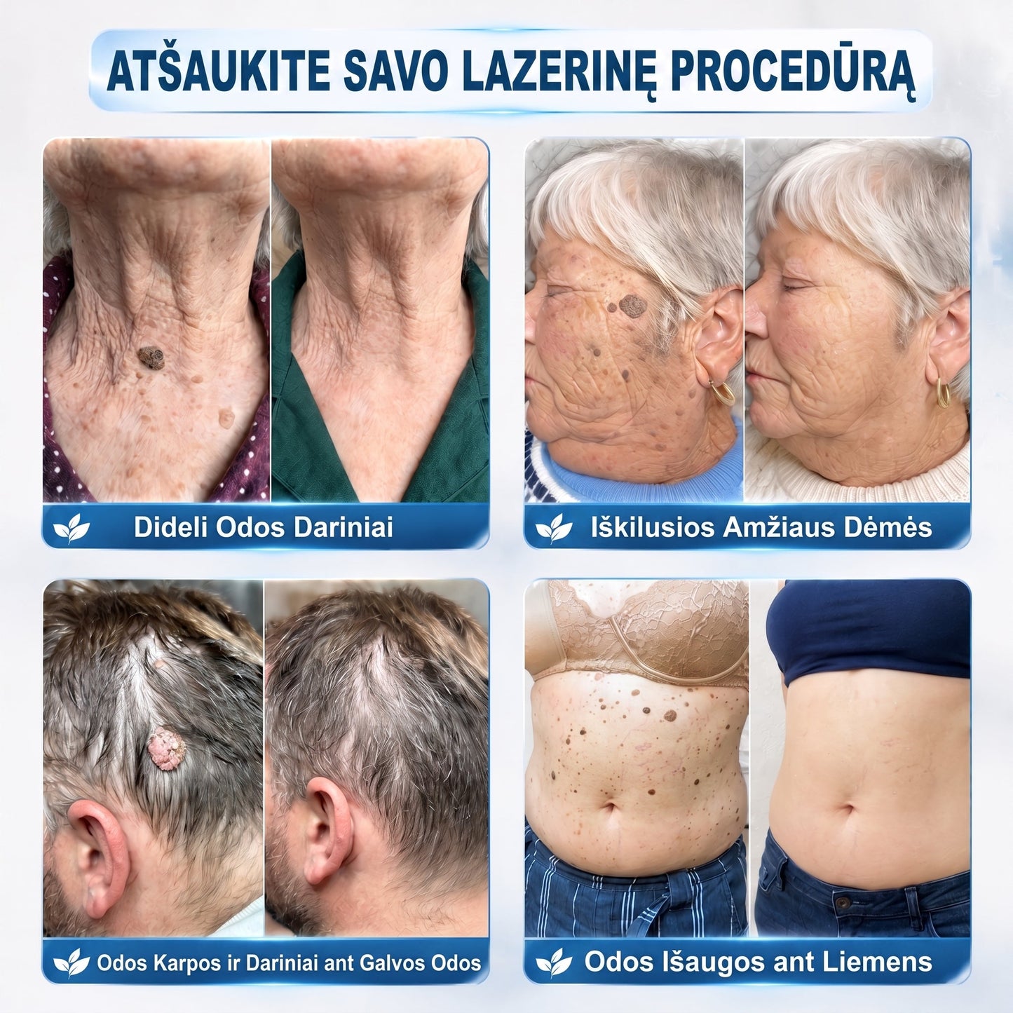 ✅✨𝐎𝐟𝐢𝐜𝐢𝐚𝐥𝐢 𝐩𝐫𝐞𝐤ė𝐬 ž𝐞𝐧𝐤𝐥𝐨 𝐩𝐚𝐫𝐝𝐮𝐨𝐭𝐮𝐯ė 𝐏𝐢𝐜𝐝𝐨® 𝟕 𝐝𝐚𝐲 𝐊𝐚𝐫𝐩𝐮𝐜𝐢𝐮 𝐢𝐫 𝐝𝐞𝐦𝐢𝐲 𝐯𝐚𝐥𝐢𝐤𝐥𝐢𝐬(Neskausmingas, be pėdsakų rutulinis rutulinis) 🚀