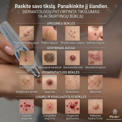 ✅✨𝐎𝐟𝐢𝐜𝐢𝐚𝐥𝐢 𝐩𝐫𝐞𝐤ė𝐬 ž𝐞𝐧𝐤𝐥𝐨 𝐩𝐚𝐫𝐝𝐮𝐨𝐭𝐮𝐯ė 𝐏𝐢𝐜𝐝𝐨® 𝟕 𝐝𝐚𝐲 𝐊𝐚𝐫𝐩𝐮𝐜𝐢𝐮 𝐢𝐫 𝐝𝐞𝐦𝐢𝐲 𝐯𝐚𝐥𝐢𝐤𝐥𝐢𝐬(Neskausmingas, be pėdsakų rutulinis rutulinis) 🚀