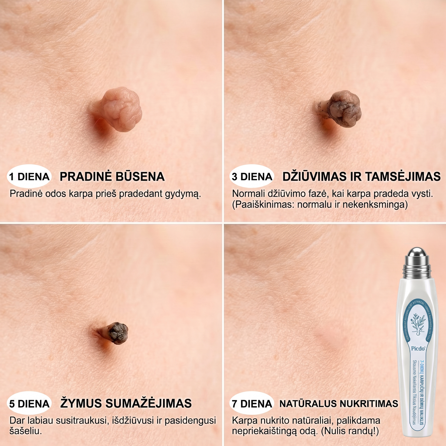 ✅✨𝐎𝐟𝐢𝐜𝐢𝐚𝐥𝐢 𝐩𝐫𝐞𝐤ė𝐬 ž𝐞𝐧𝐤𝐥𝐨 𝐩𝐚𝐫𝐝𝐮𝐨𝐭𝐮𝐯ė 𝐏𝐢𝐜𝐝𝐨® 𝟕 𝐝𝐚𝐲 𝐊𝐚𝐫𝐩𝐮𝐜𝐢𝐮 𝐢𝐫 𝐝𝐞𝐦𝐢𝐲 𝐯𝐚𝐥𝐢𝐤𝐥𝐢𝐬(Neskausmingas, be pėdsakų rutulinis rutulinis) 🚀