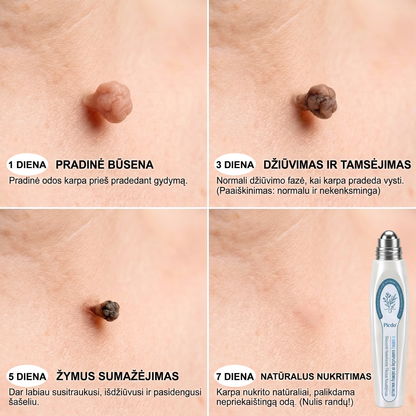✅✨𝐎𝐟𝐢𝐜𝐢𝐚𝐥𝐢 𝐩𝐫𝐞𝐤ė𝐬 ž𝐞𝐧𝐤𝐥𝐨 𝐩𝐚𝐫𝐝𝐮𝐨𝐭𝐮𝐯ė 𝐏𝐢𝐜𝐝𝐨® 𝟕 𝐝𝐚𝐲 𝐊𝐚𝐫𝐩𝐮𝐜𝐢𝐮 𝐢𝐫 𝐝𝐞𝐦𝐢𝐲 𝐯𝐚𝐥𝐢𝐤𝐥𝐢𝐬(Neskausmingas, be pėdsakų rutulinis rutulinis) 🚀