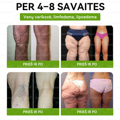 👉 Oficialus sertifikavimas 🔥 Tūkstančiai patenkintų vartotojų Lietuvoje💗👍𝐆𝐞𝑒𝐿𝑒𝐦𝐨𝐧® 𝐆𝐥𝐮𝐦𝐚𝐬𝐞𝐭𝐢𝐝𝐞 8 viename Liekninantis ir sveikatinantis nano pleistras su mikroadatomis 🇱🇹 (Tik kartą per dieną, matomi pokyčiai jau per 7 dienas)  ✅